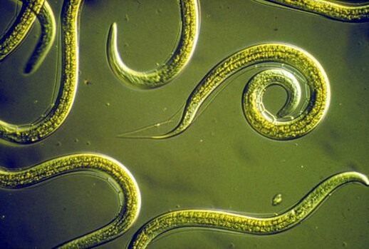 Viermi nematozi paraziți în intestinul subțire uman